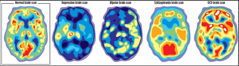 Brain scans of people with mental illness vs. a normally functioning brain.